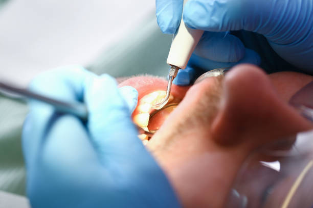 Best Emergency Treatment for Toothache in Clarence, IA
