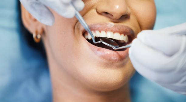 Best After-Hours Emergency Dentist in Clarence, IA