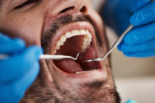 Best Emergency Treatment for Toothache in Clarence, IA