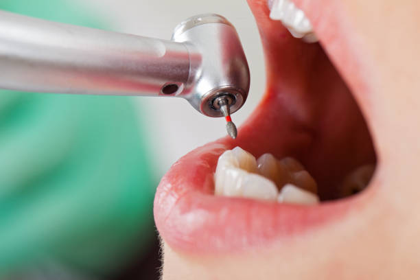 Best Walk-In Emergency Dentist in Clarence, IA